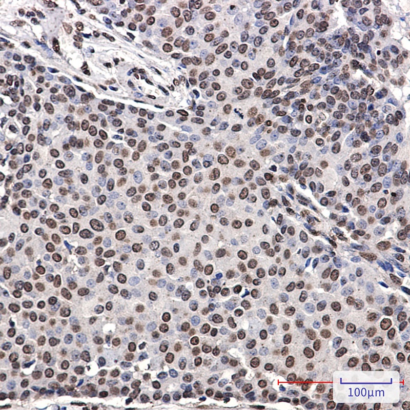 Phospho-ErbB 4 (Tyr1162) Rabbit mAb