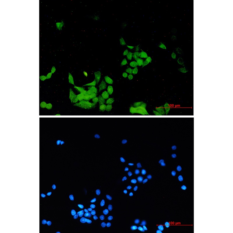Phospho-EGFR (Tyr1173) Rabbit mAb