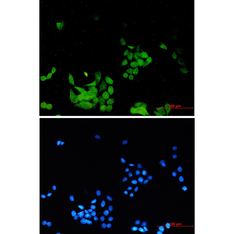 EGFR Antibody