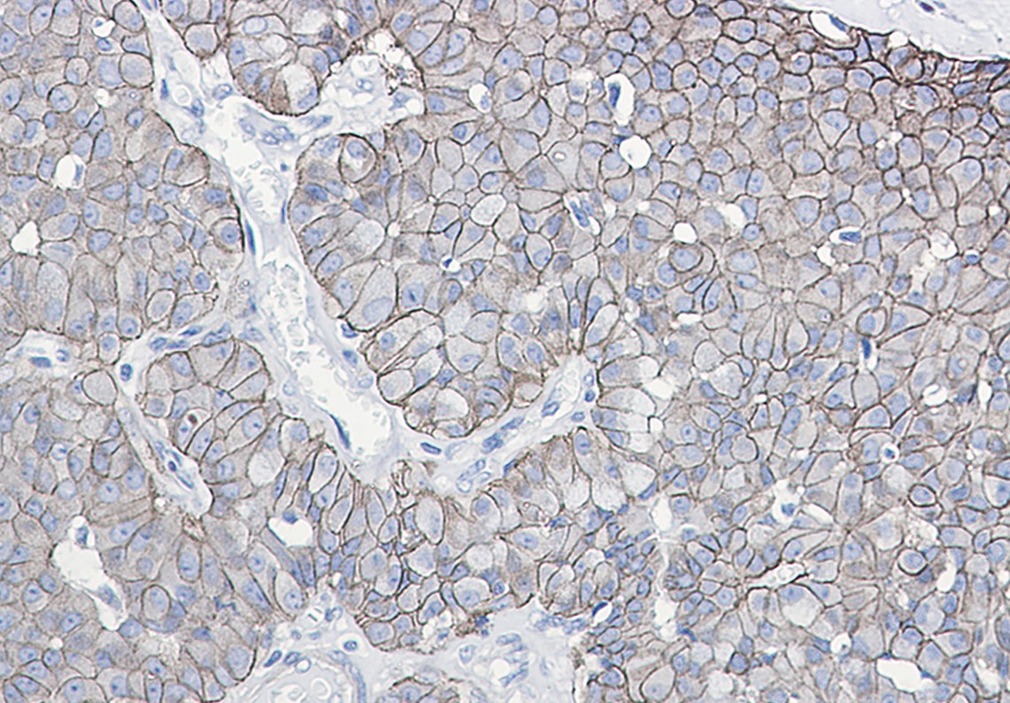 CDH1 Antibody