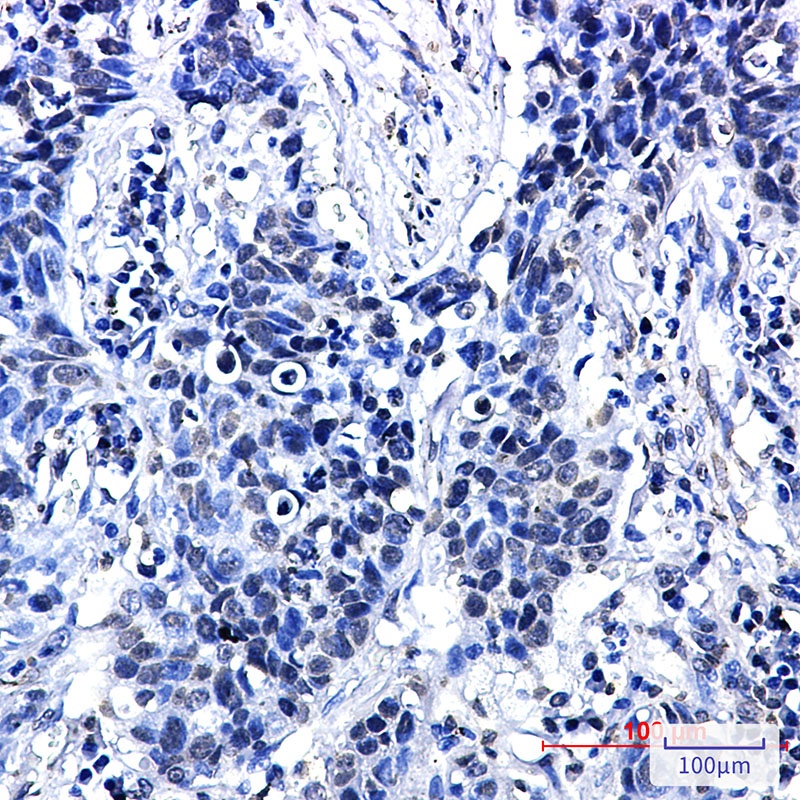 CTNND1 Antibody