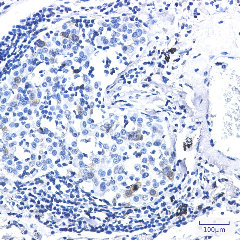 Phospho-CDK1/2 (Thr14) Rabbit mAb