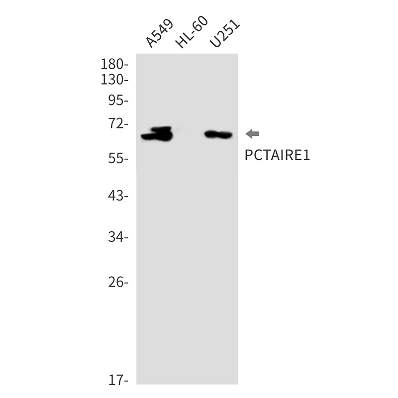 CDK16 Rabbit Monoclonal Antibody