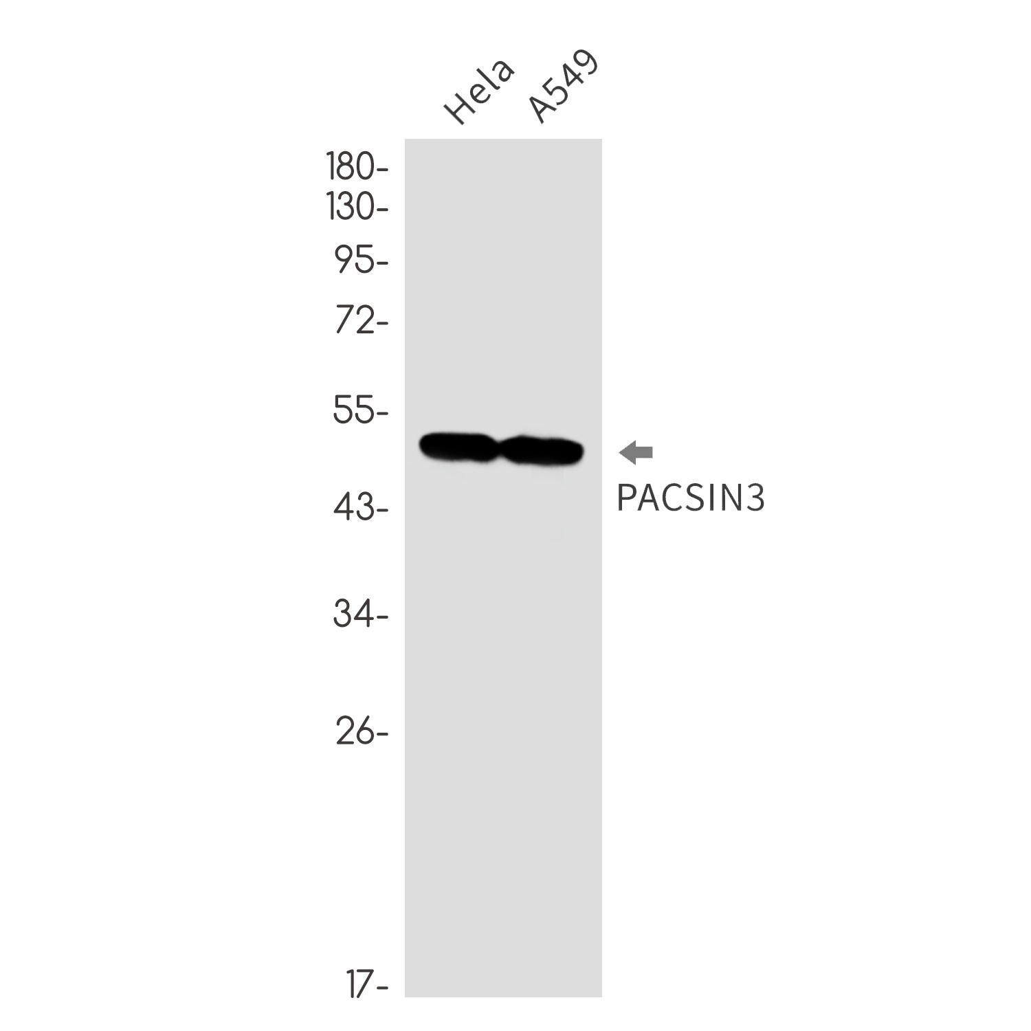 PACSIN3 Antibody