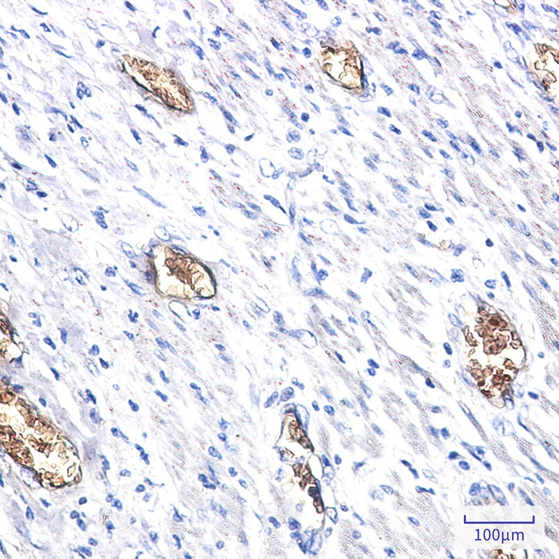 PACSIN3 Rabbit mAb
