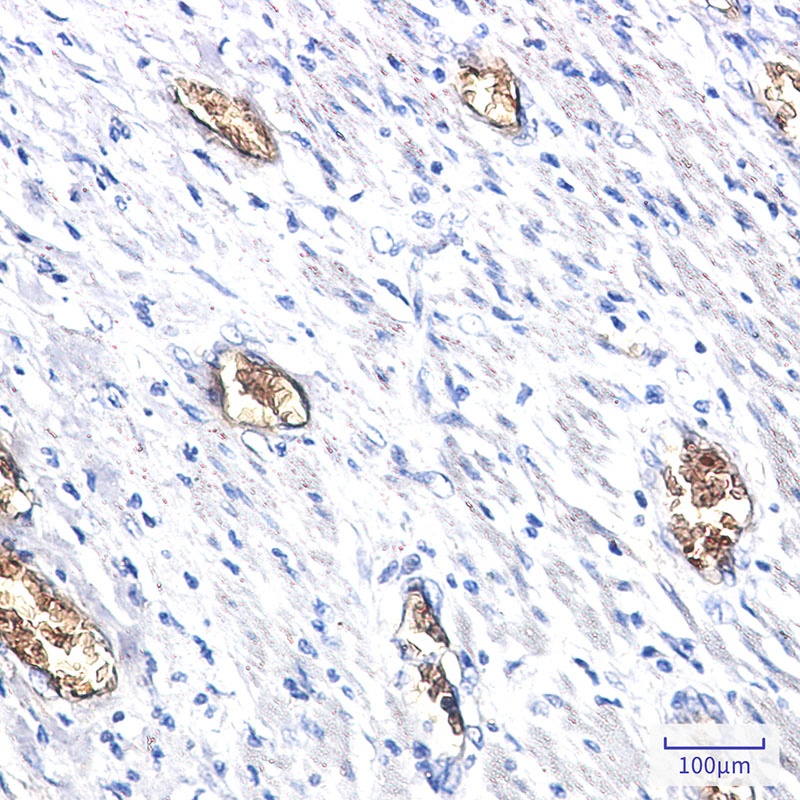 PACSIN3 Antibody