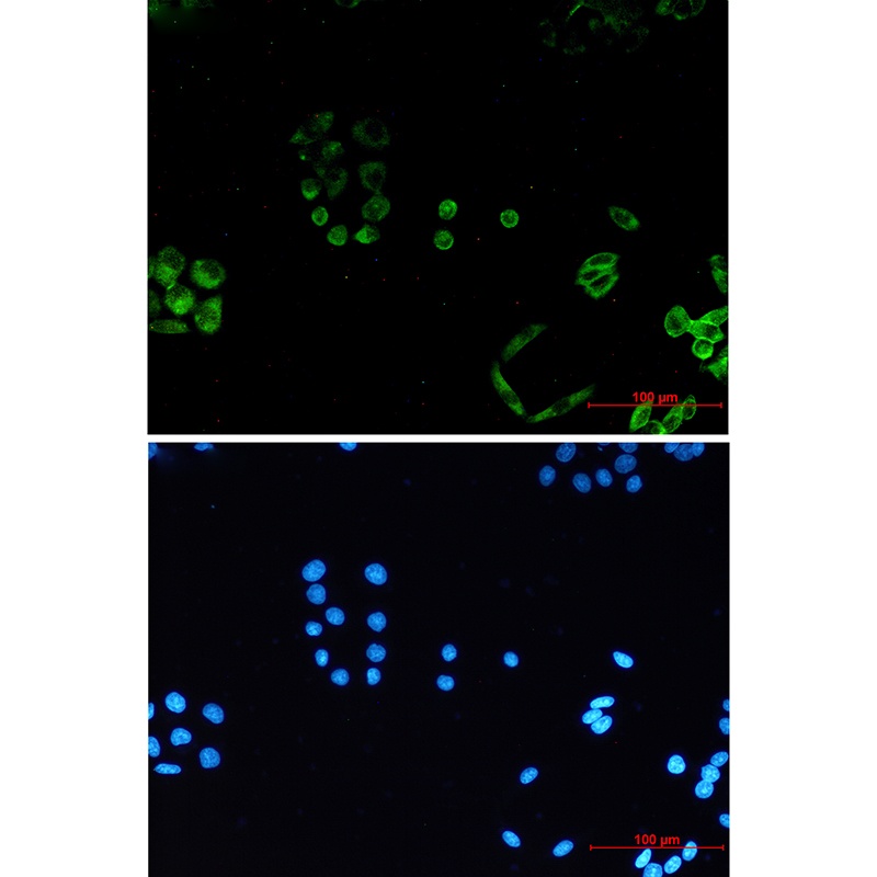 PACSIN3 Rabbit mAb