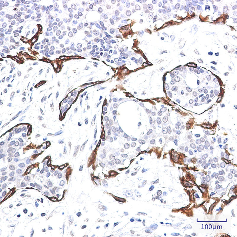 Cytokeratin 17 Rabbit mAb