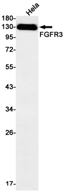 FGFR3 Rabbit mAb