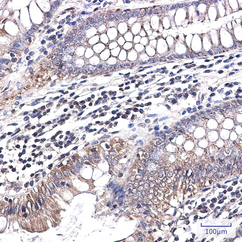 NDUFB1 Rabbit mAb