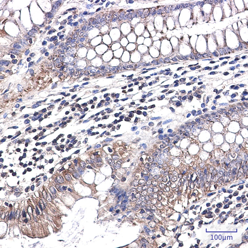 NDUFB1 Antibody