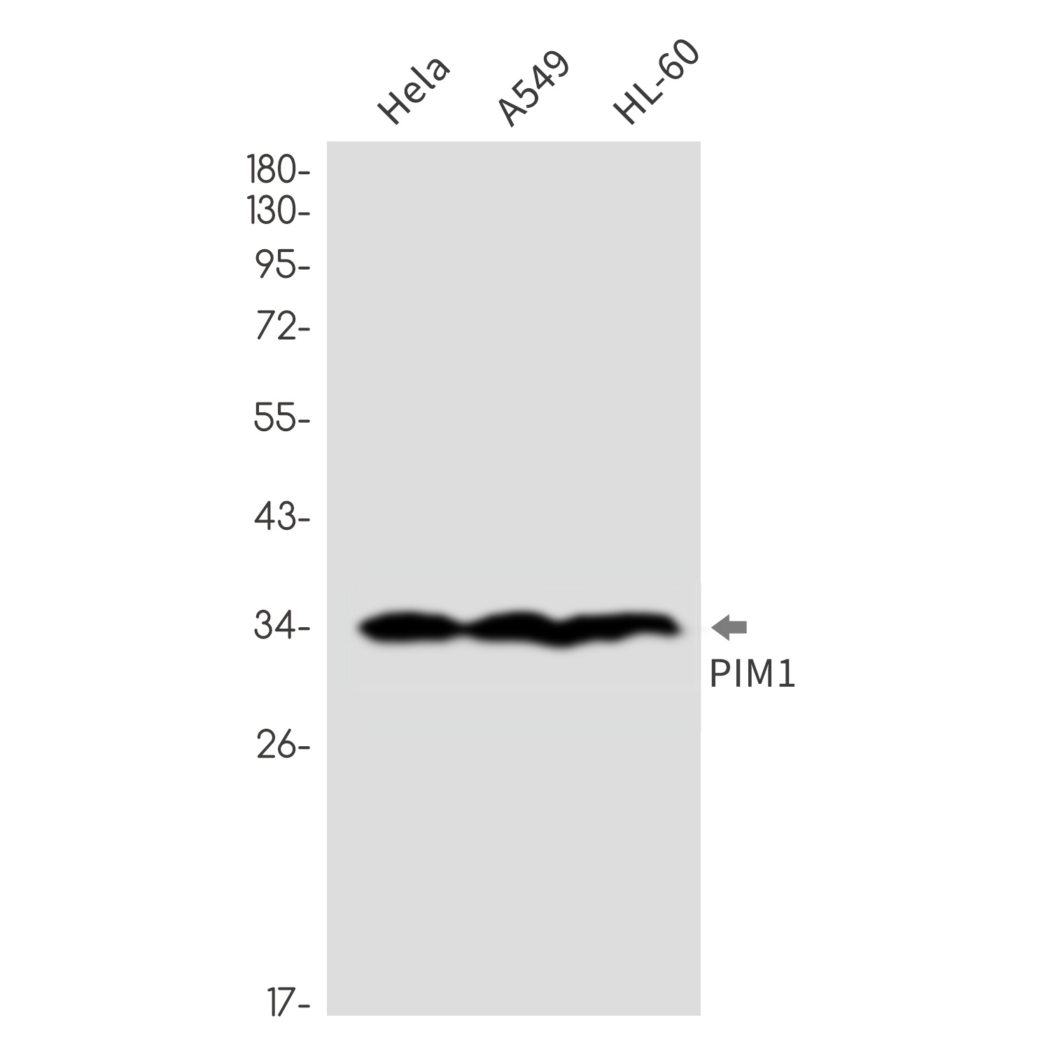 PIM1 Antibody