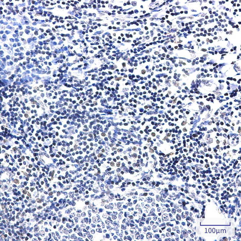 PIM1 Antibody