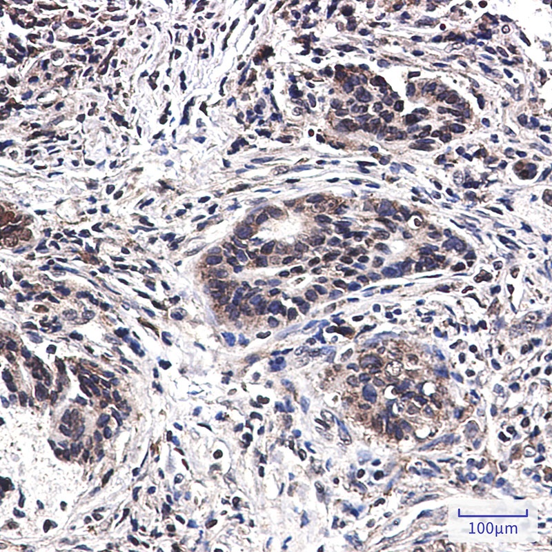 MST1 Rabbit mAb