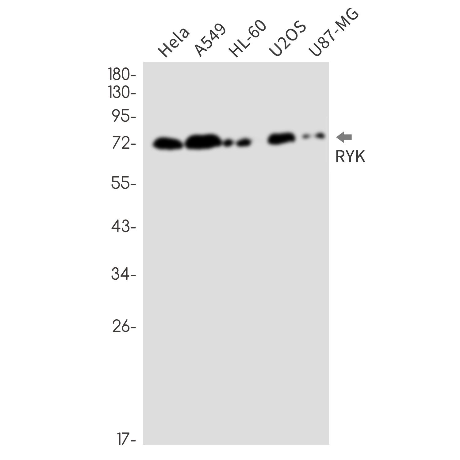 RYK Antibody
