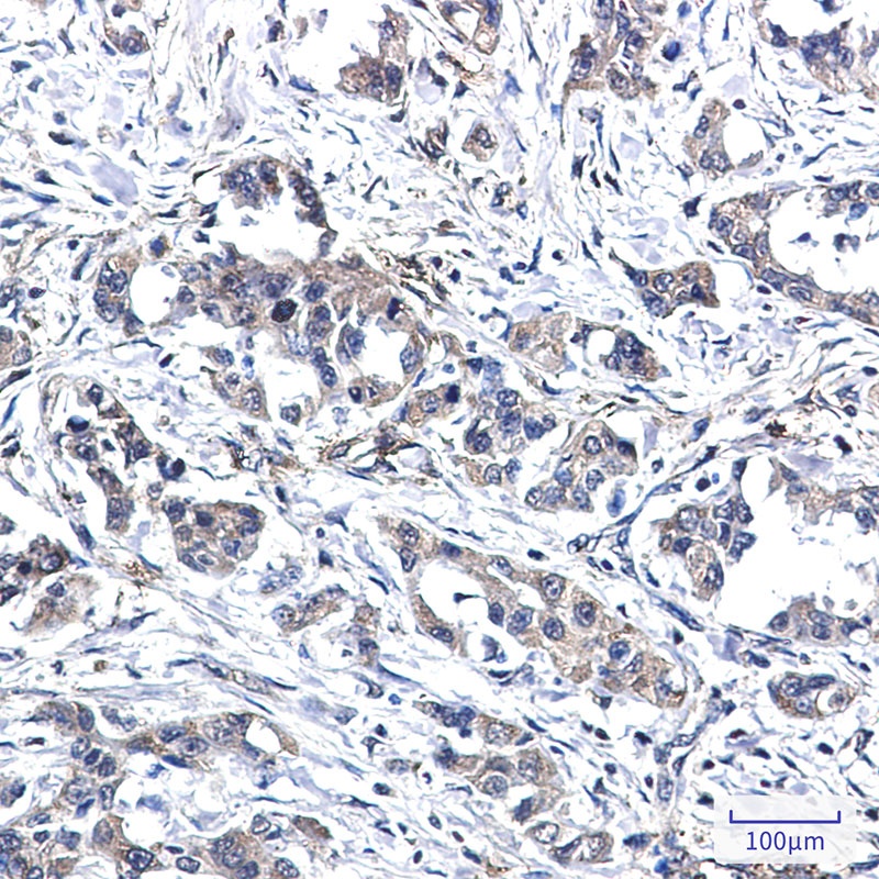 RYK Antibody