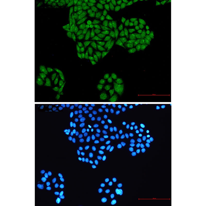 RYK Antibody