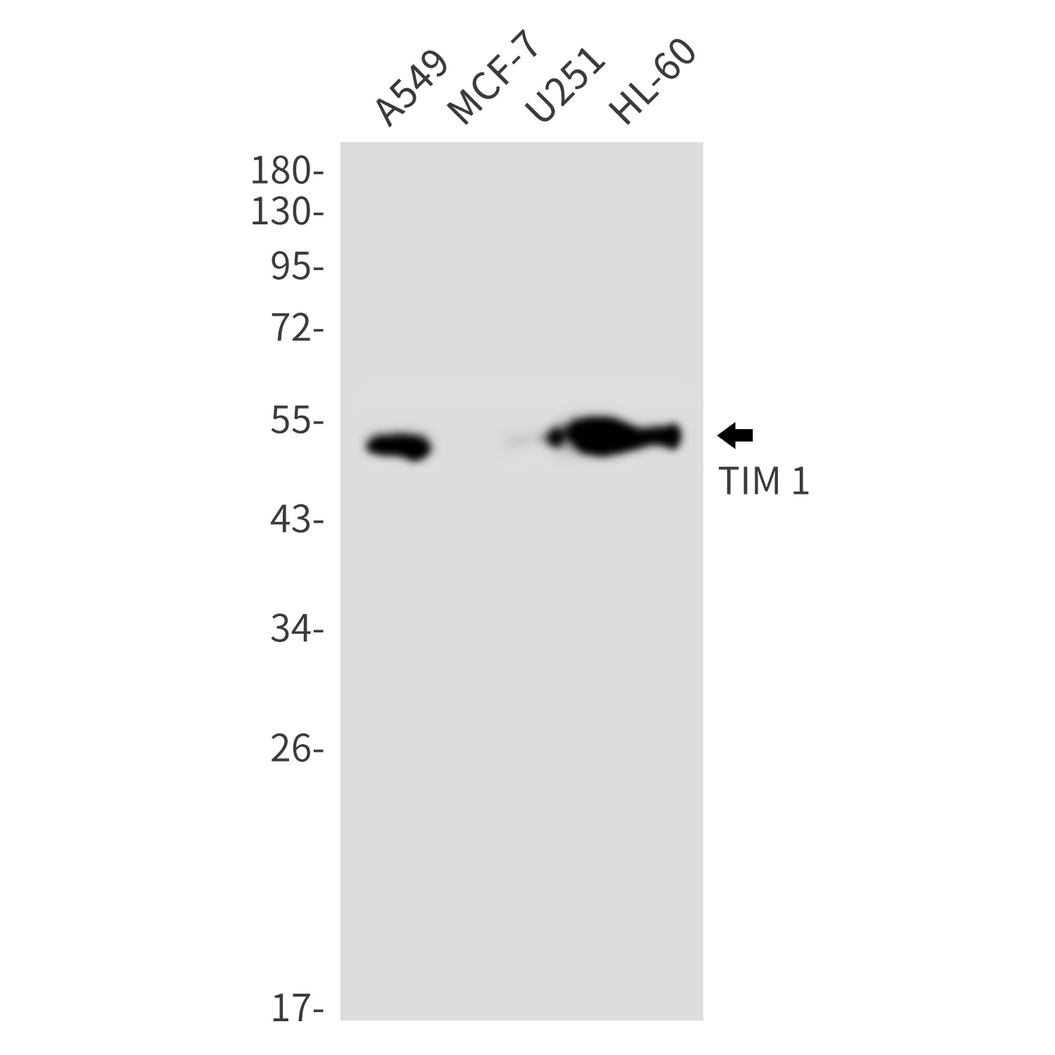 HAVCR1 Antibody