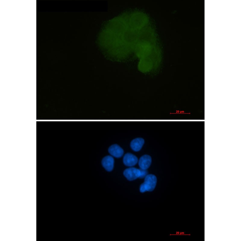MAP2K1 Antibody