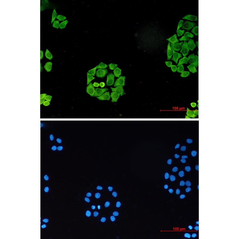 Surfeit Locus Protein 4 Rabbit mAb