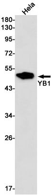 YB1 Rabbit mAb