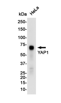 YAP1 Rabbit mAb