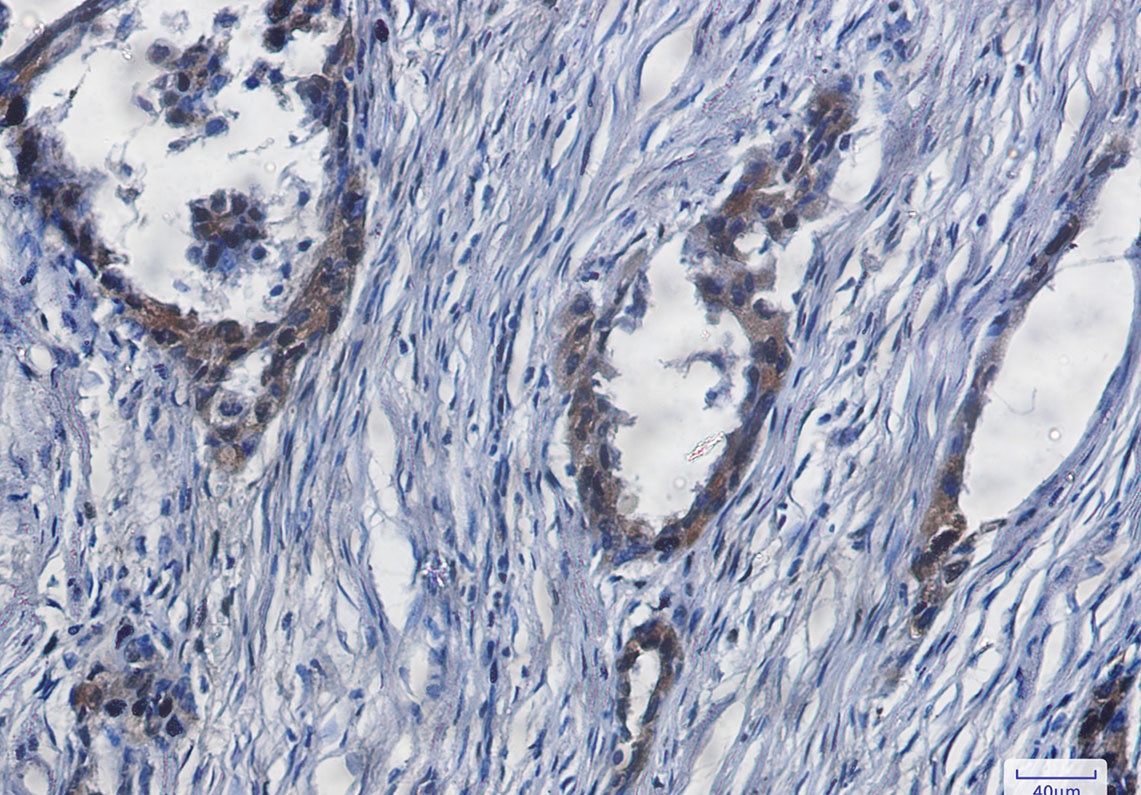 YAP1 Rabbit mAb