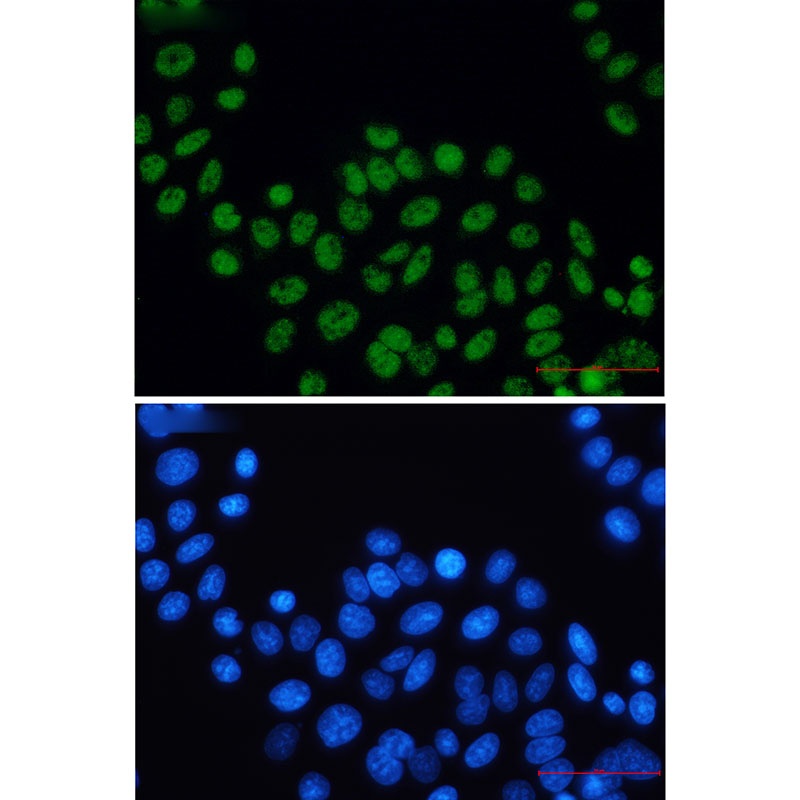 ERCC2 Antibody