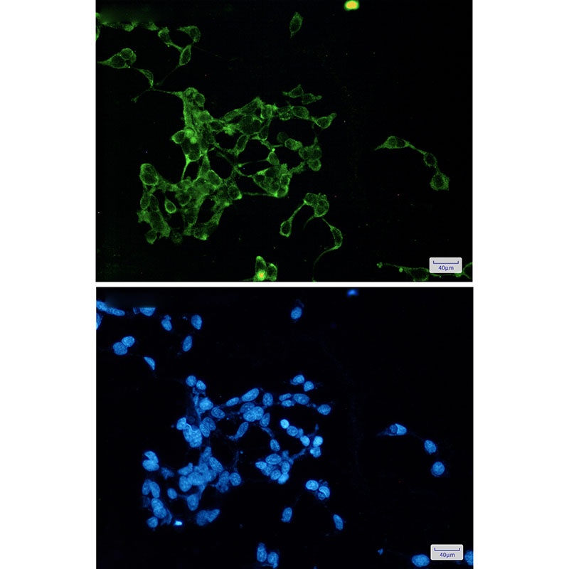 WNT2B Antibody