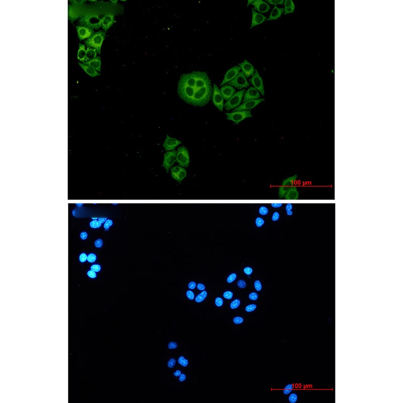 WDR1 Rabbit mAb
