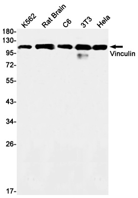 Vinculin Rabbit mAb