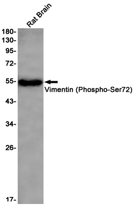 VIM Antibody