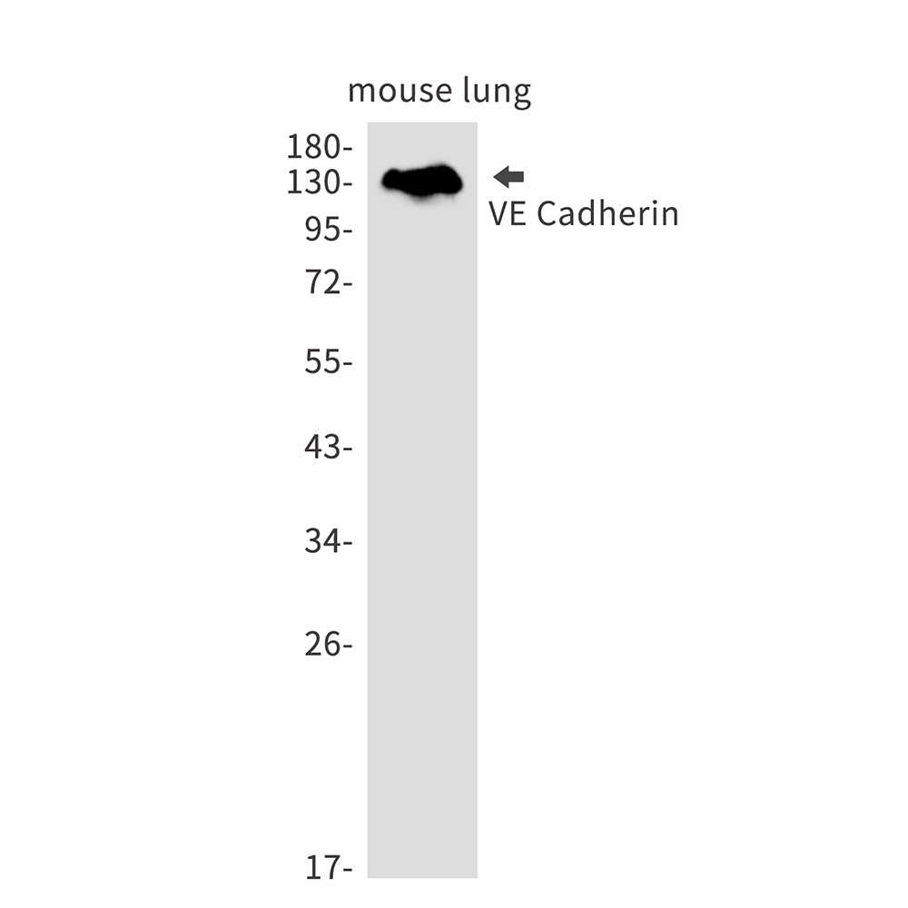 Cadherin 5 Rabbit mAb
