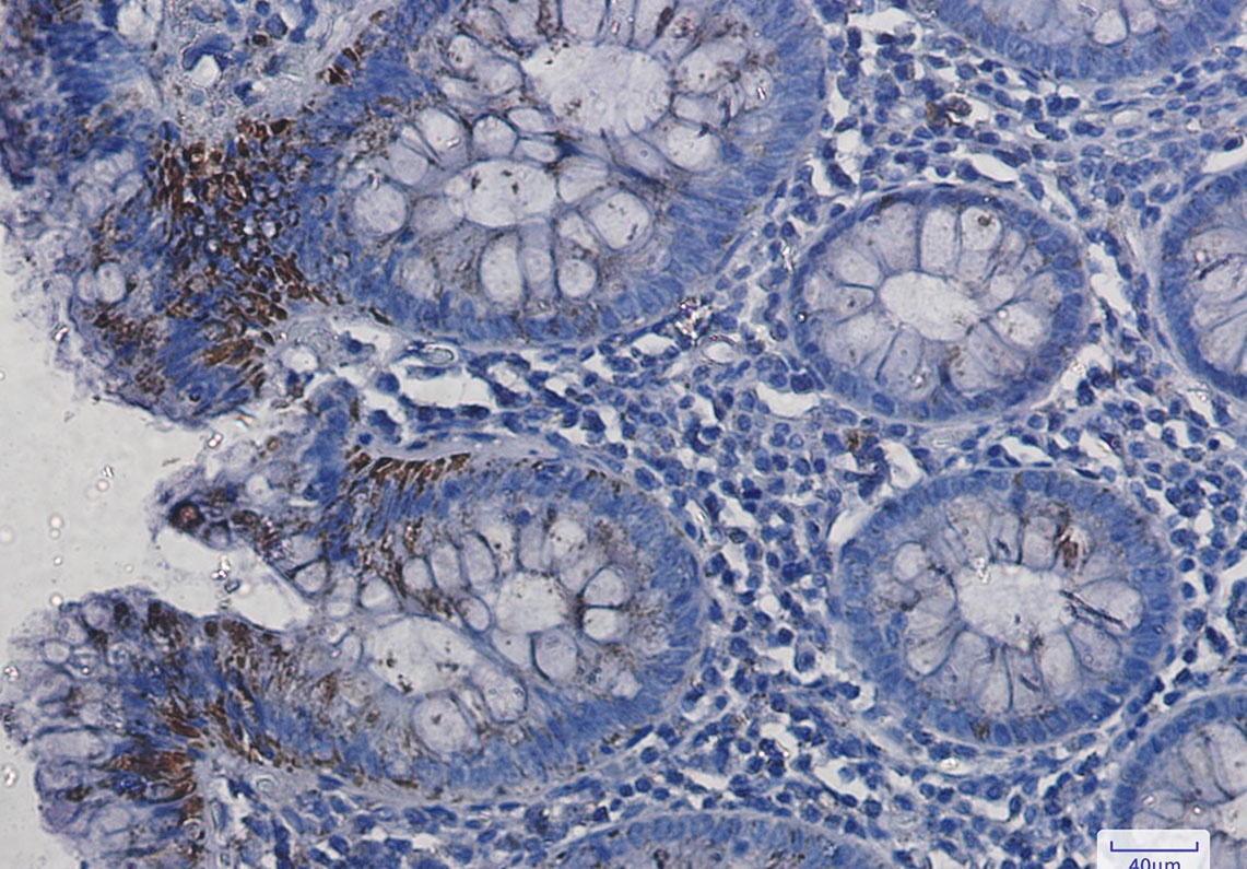VDAC1 Antibody