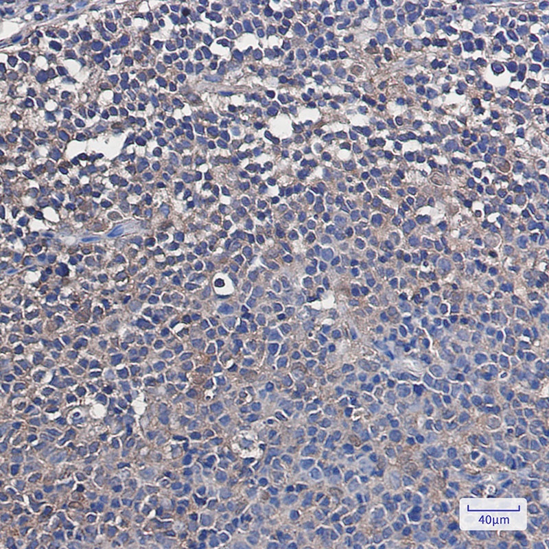 VCP Rabbit mAb