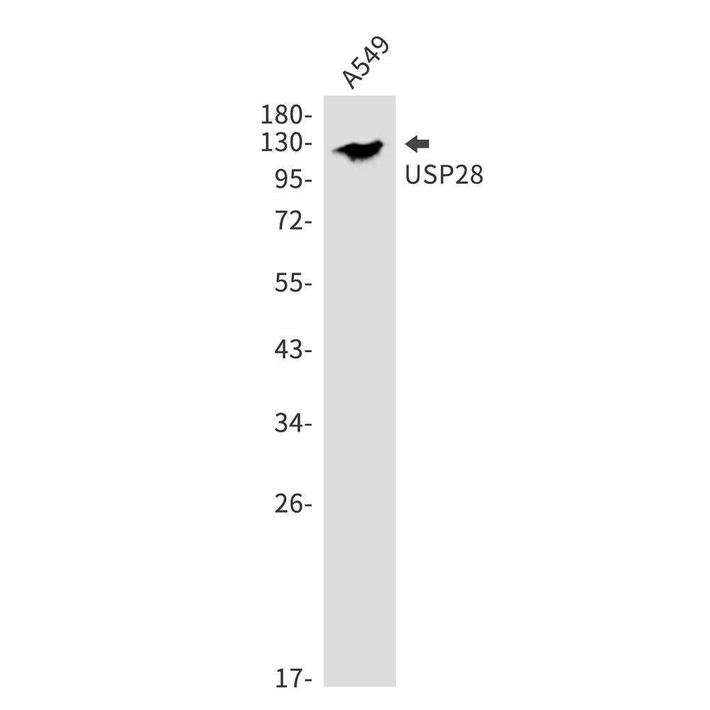 USP28 Rabbit Monoclonal Antibody