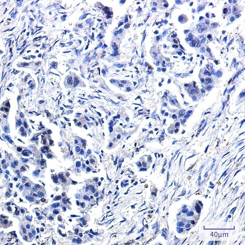 USP10 Rabbit mAb
