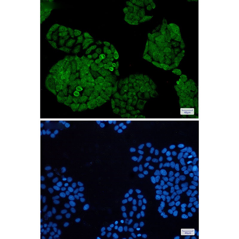 UCHL5 Antibody