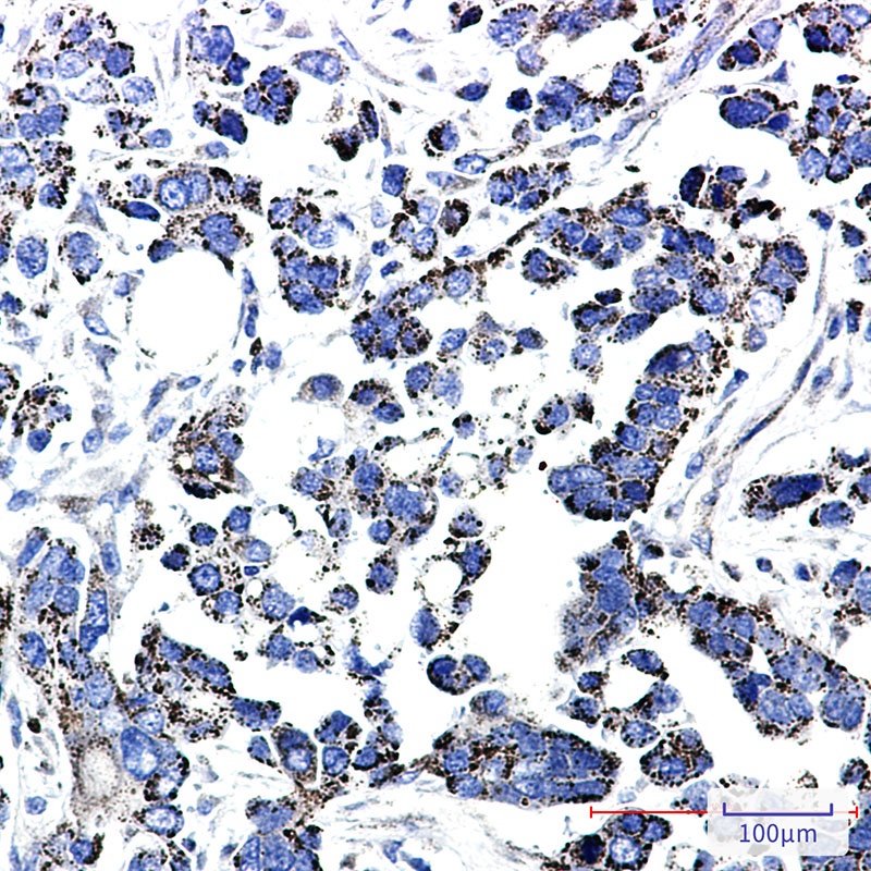 Thioredoxin Reductase 2 Rabbit mAb