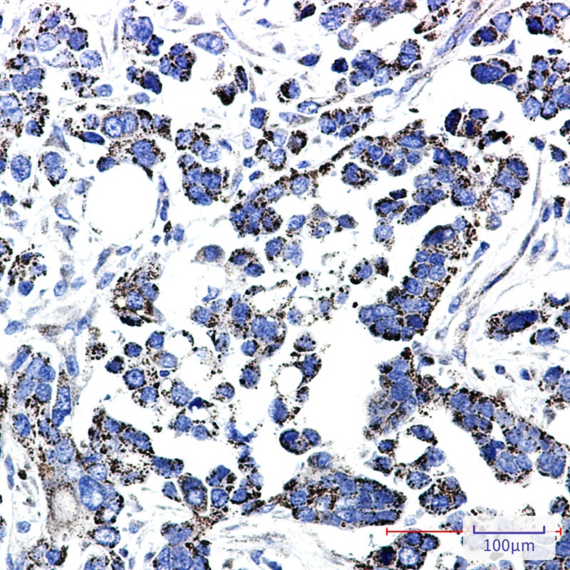 TXNRD2 Antibody