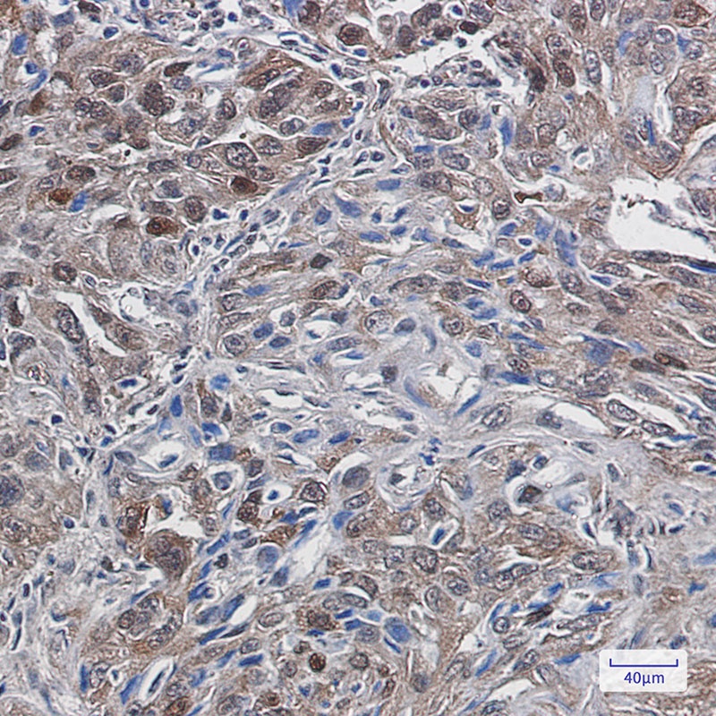 Thioredoxin Reductase 1 Rabbit mAb