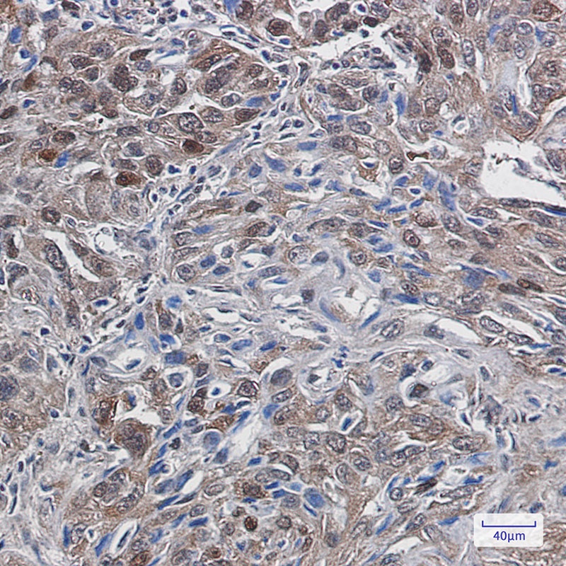 TXNRD1 Antibody