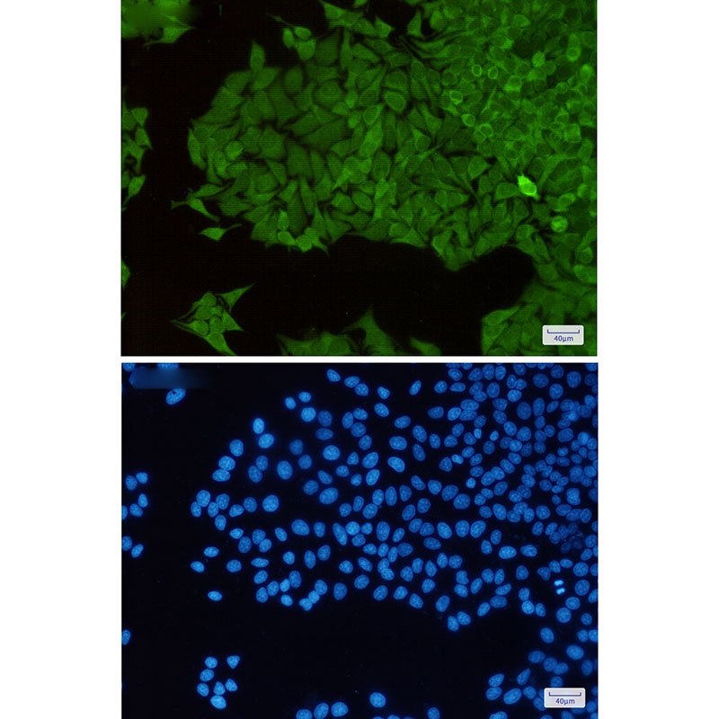 Thioredoxin Reductase 1 Rabbit mAb