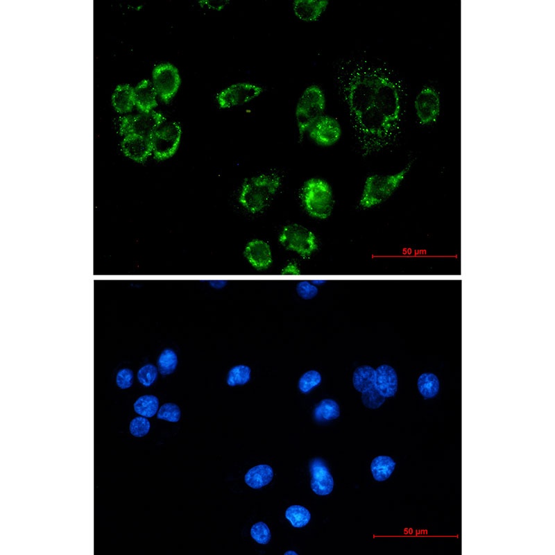 Mitochondrial Fission 1 Protein Rabbit mAb