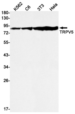 TrpV5 Rabbit Monoclonal Antibody