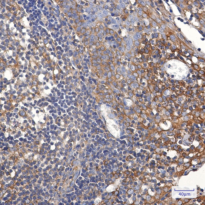 TFG Antibody