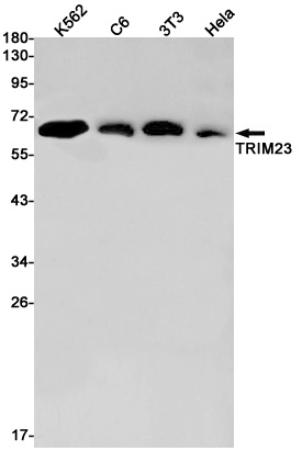 TRIM23/ARD1 Rabbit Monoclonal Antibody