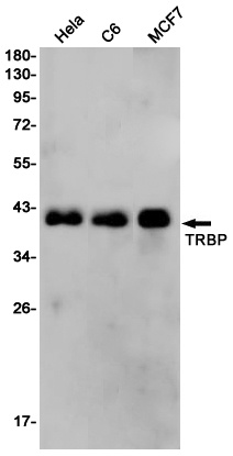TARBP2 Rabbit mAb