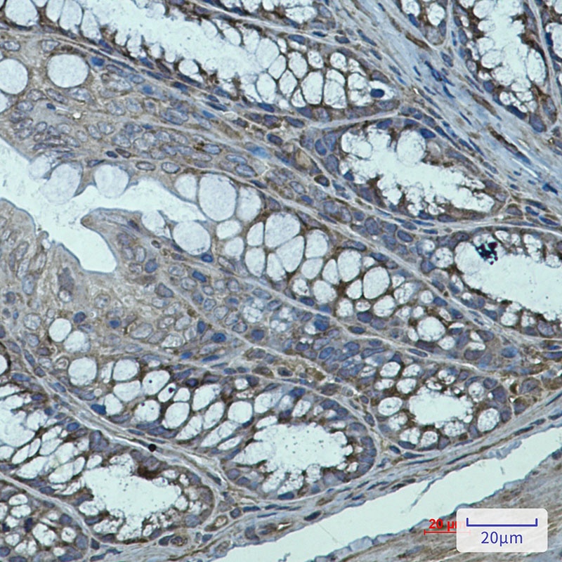 TGM2 Antibody