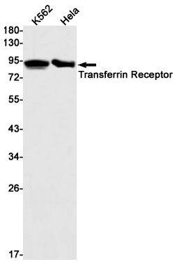 Transferrin Receptor 1 Rabbit mAb